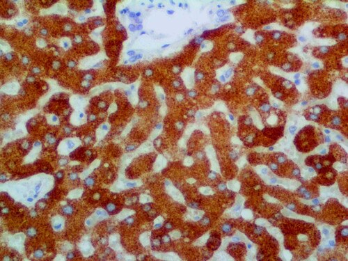 IHC of COX-2 on an FFPE Liver Tissue